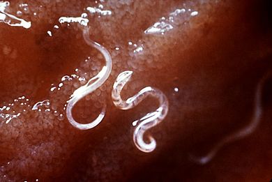 microscopic picture of hookworms